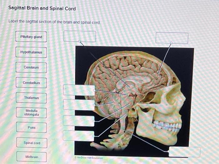 Label the sagittal section of the brain and spinal cord